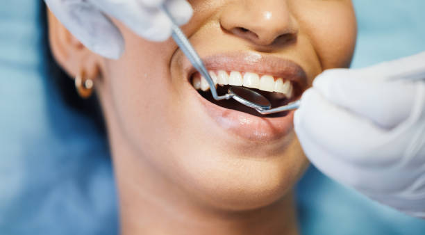 Best Pediatric Emergency Dentist in Manche North Shore, CA