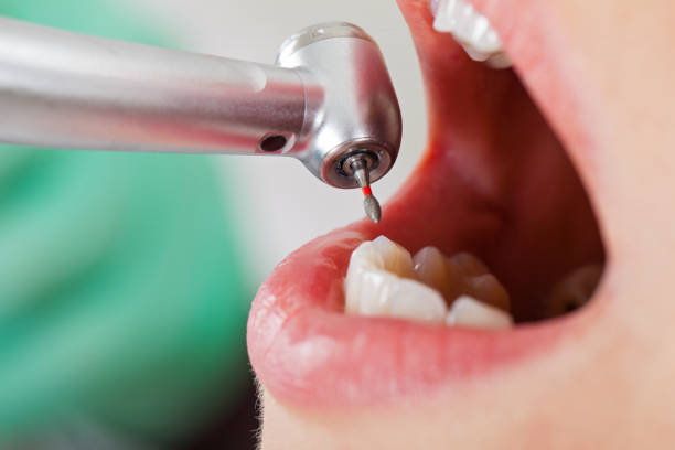 Best Emergency Orthodontic Repairs in Manche North Shore, CA